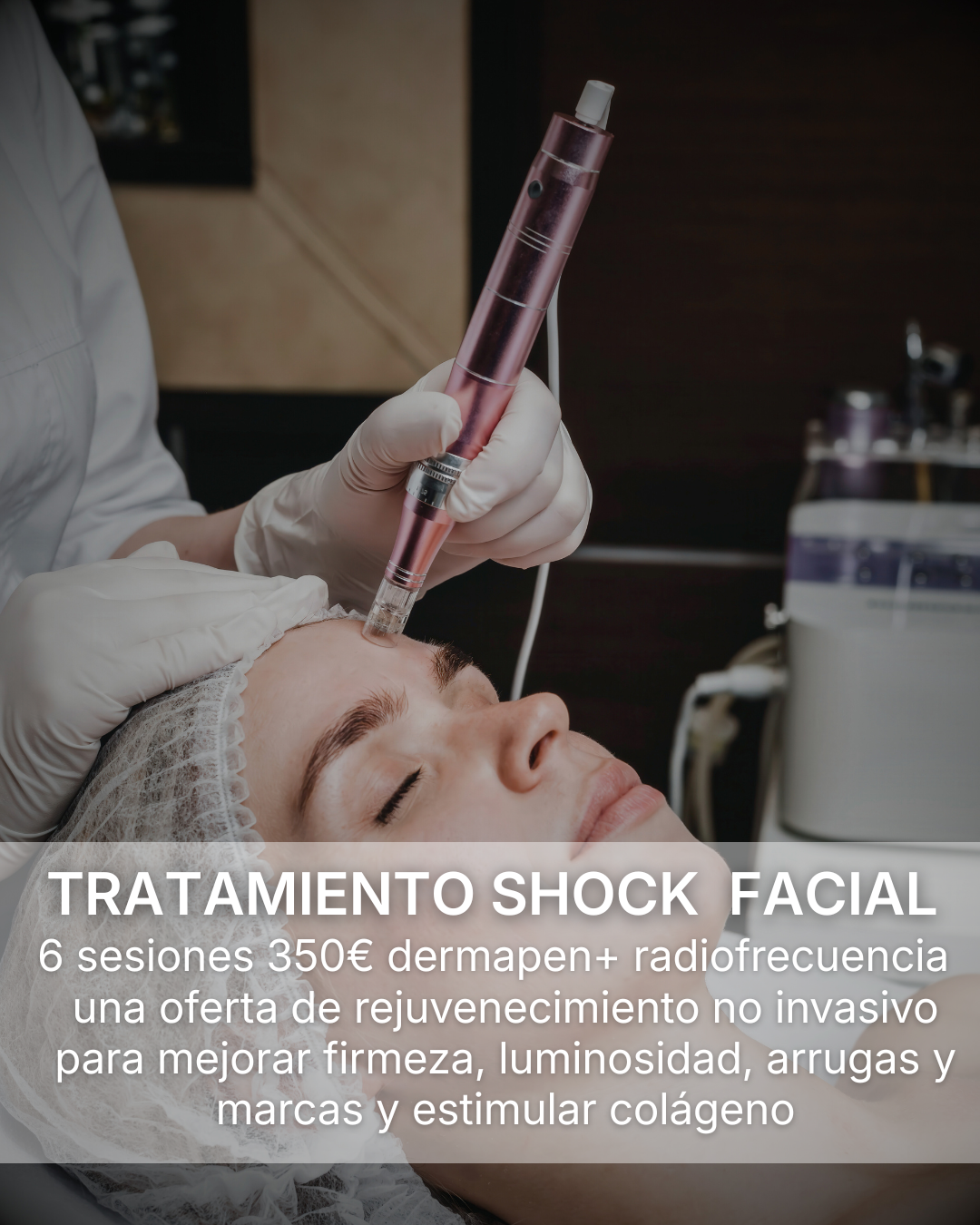 Tratamiento shock facial - Dermapen y Radiofrecuencia