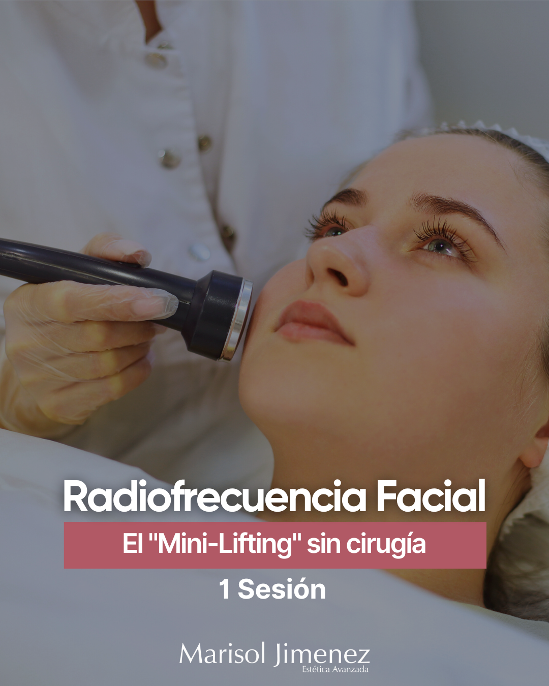 Radiofrecuencia Facial - 1 Sesión