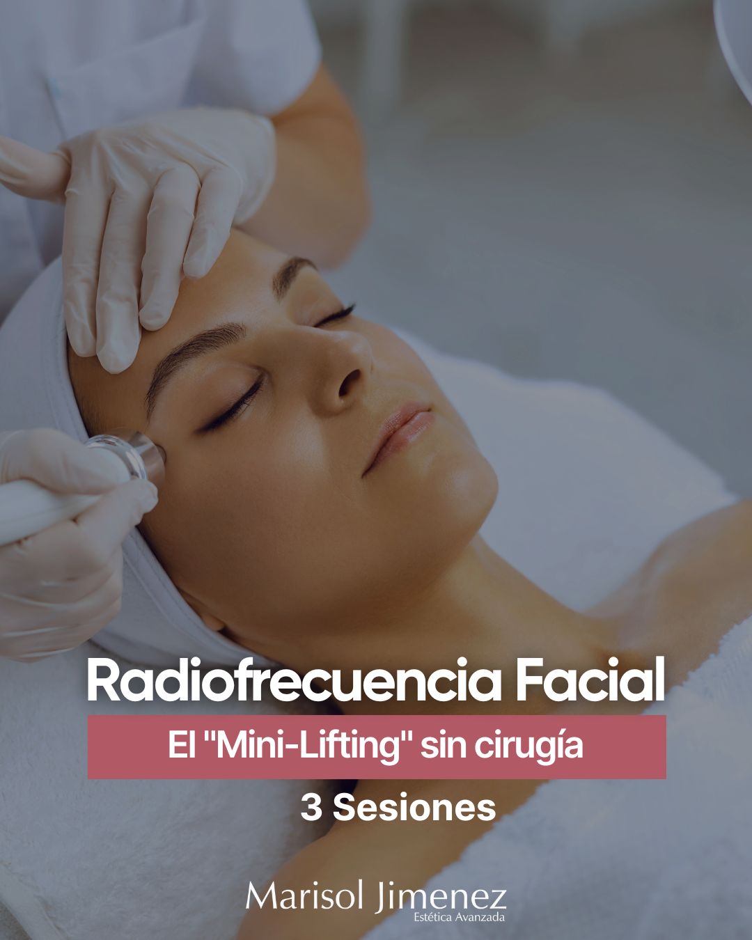 Radiofrecuencia Facial - 3 Sesiones